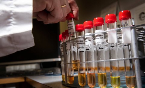 COVID-19: Sóttkví og einangrun – reglur um styttri tíma